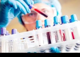 Blood sample
