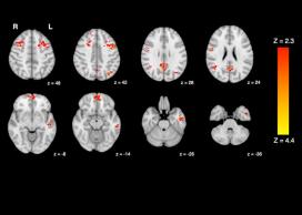 Brain scan