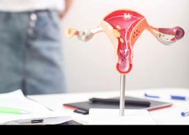 Hysterectomy